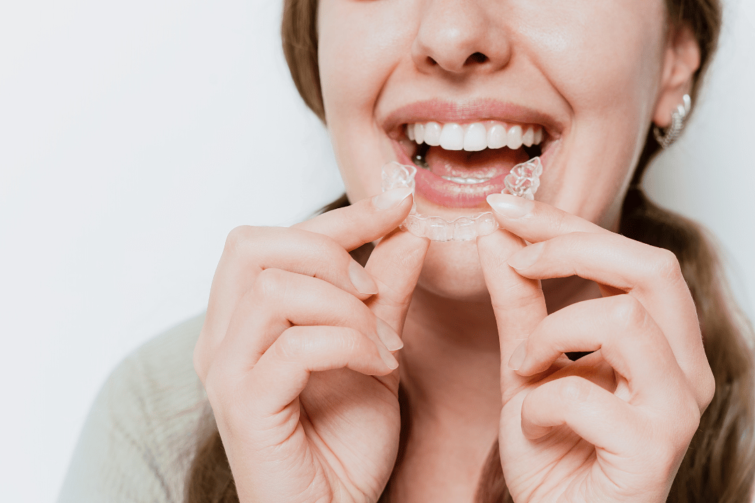 kids Invisalign closter