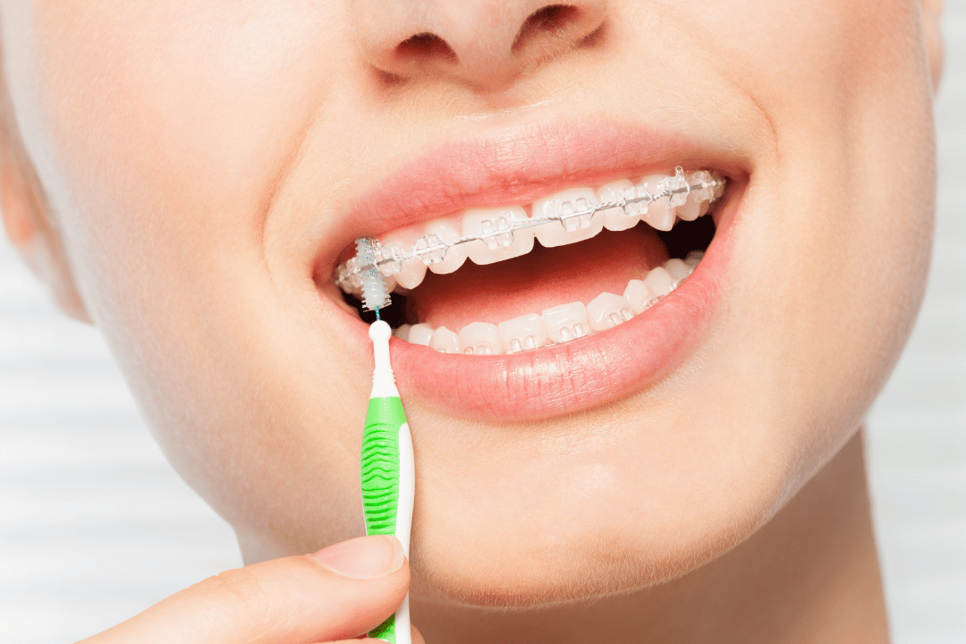 teen braces closter