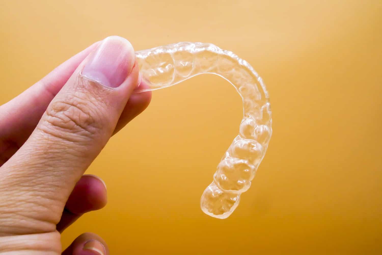 How Long Does Invisalign Take? Treatment Timeline Explained