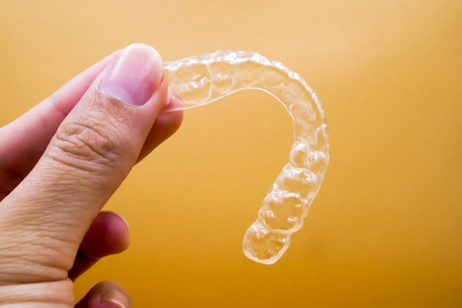 How long does Invisalign treatment take?