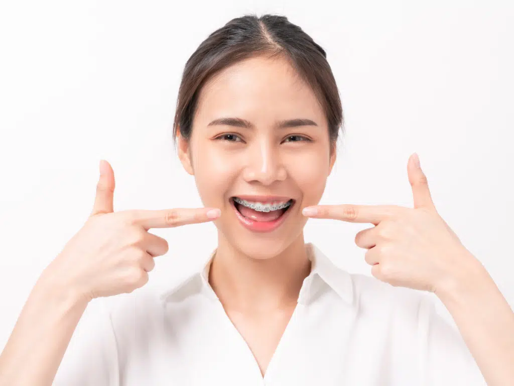 The Hidden Benefits of Adult Orthodontics