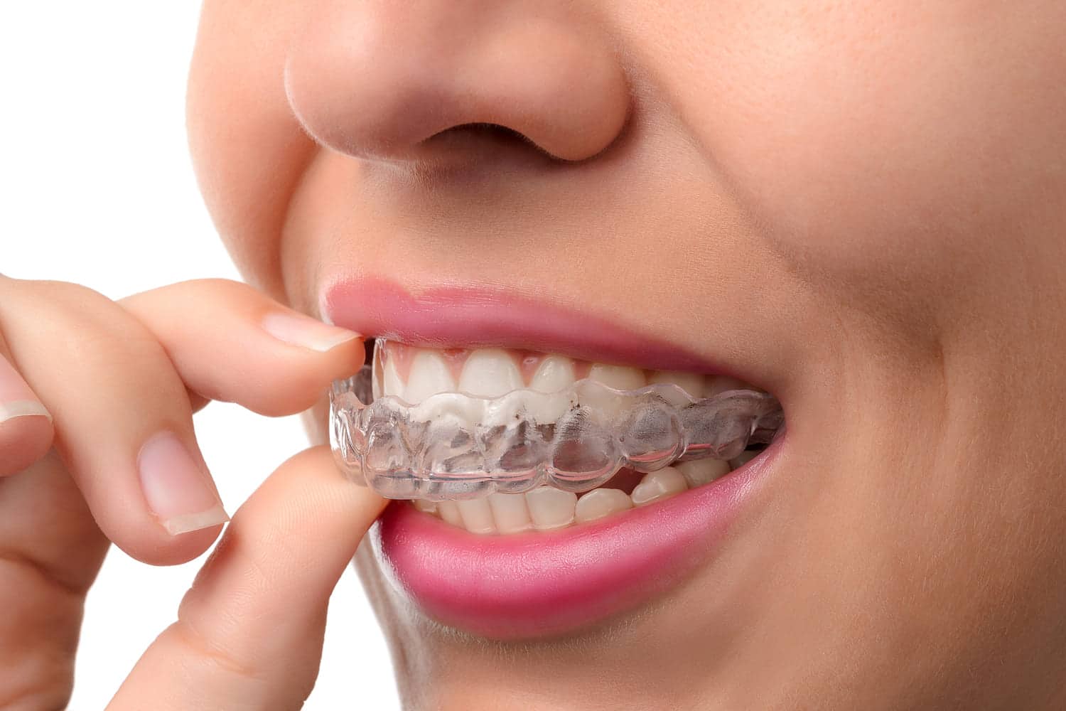 How to Clean and Care for Invisalign: A Daily Guide
