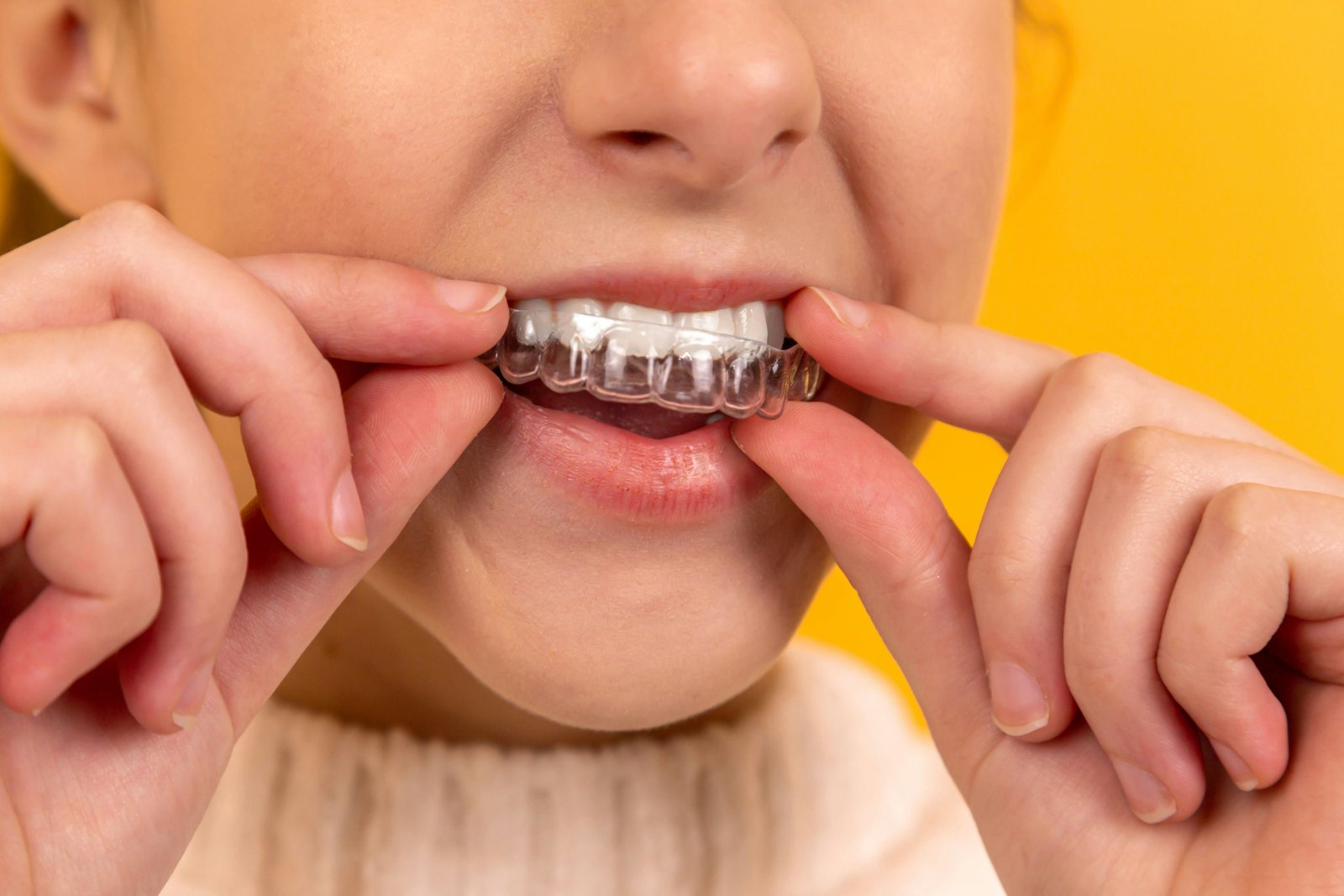 Clear aligner patient